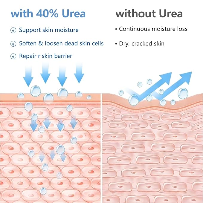 Urea Cream 40% Plus Salicylic Acid 2%, Urea Cream 40 Percent for Feet Maximum Strength, Foot Cream for Dry Heels Cracked