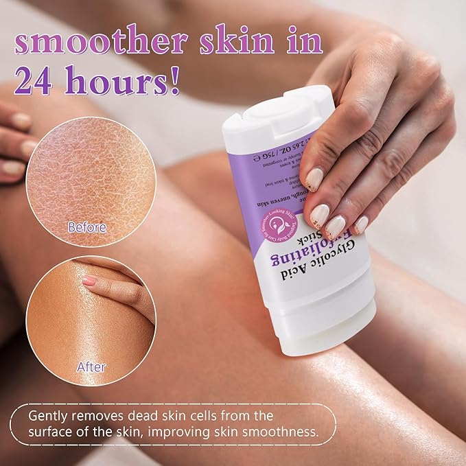 Glycolic Acid Exfoliating Body Stick 75g - 7% AHA + 0.5% BHA & Shea Butter Exfoliating Stick for Rough Skin，Gentle Peel for Arms, Legs & Back