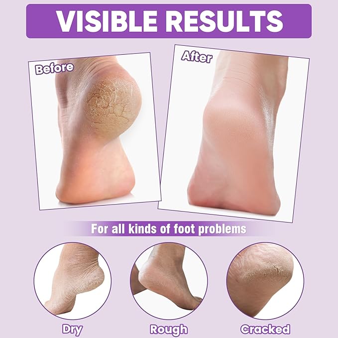 TEAWOO 16 Pairs Moisturizing Foot Masks with Lavender Oil & Jojoba Oil, Intensely Hydrating Foot Mask for Dry Cracked Feet, Moisturizing Socks for Cracked Heel Treatment