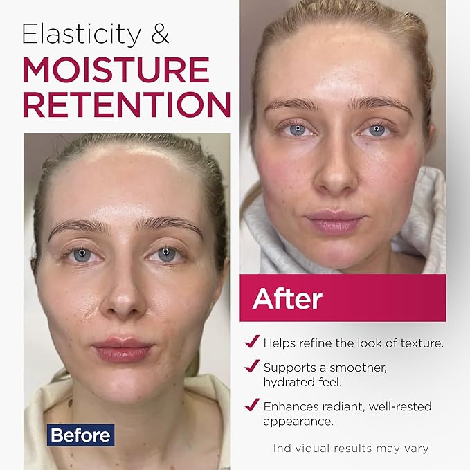 Retinol Collagen Cream for Face Retinol 1% Hyaluronic Acid Niacinamide for All Skin Types Face Moisturizer with Airless Pump Day & Night Cream - Made in USA