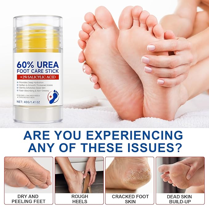 60% Urea Cream Stick with 2% Salicylic Acid, Exfoliating Moisturizing Foot Cream for Dry Rough Skin, Callus Softening Heel Balm Stick for Cracked Heels, Foot Care for Hands Elbows Knees 1.4oz