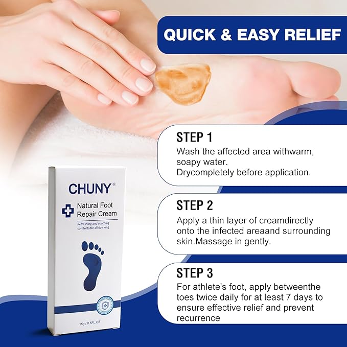 Foot Cream for Cracked Heels Cream - Extra Strength for Cracked Heels, Dry Skin & Itchy Feet – Soothes Burning, Scaling & Irritation for Men and Women