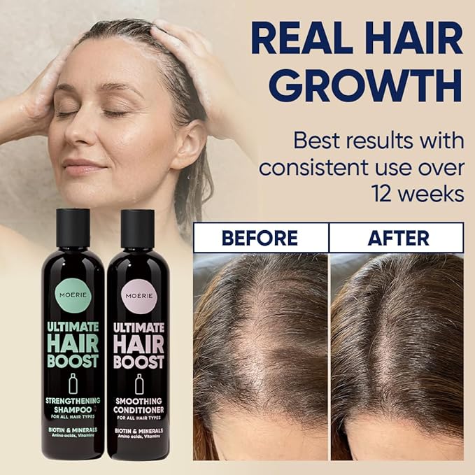 Moerie Hair Growth Shampoo and Conditioner for Women and Men, Hair Loss Solution with Biotin and Rosemary, Thickening Shampoo and Conditioner for Thinning Hair – Promotes Regrowth, Double Set