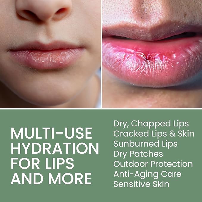 THENA Natural Wellness Organic Lip Balm & Moisturizer for Cracked & Very Dry Lips, Barrier Repair Lip Treatment for Dry Cracked Lips with Shea Butter & Vanilla, Hydrating Therapy, 3 Pack, Women & Men