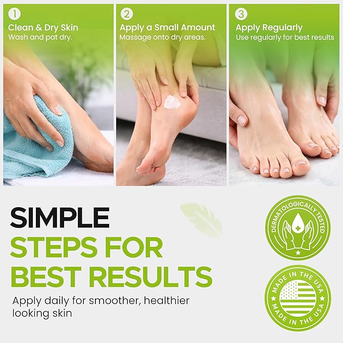 CLEAR 20, 20% Urea Gel, 4 oz w/ Tea Tree & Coconut Oil, Aloe Vera Extract, Callus & Corn Remover Moisturizes & Softens Cracked Heels, Feet, Elbows, Hands, Nails, Superior hydration to Urea Creams
