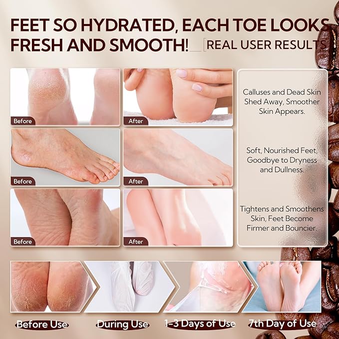 LANBENA Coffee Foot Peel Mask, Exfoliator Peel Off Calluses Dead Skin Callus Remover, Repair Rough Heels & Get a Smooth Skin for Men and Women(2 Pairs)