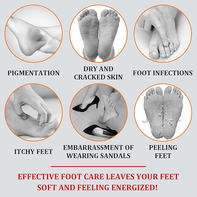 Foot Peeling Spray Oil,Moisturizing Nourishing Foot Exfoliating Peeling Spray,Instantly Hydrating Gently Foot Peel Off Spray for Removing Dead Skin & Calluses（Orange）