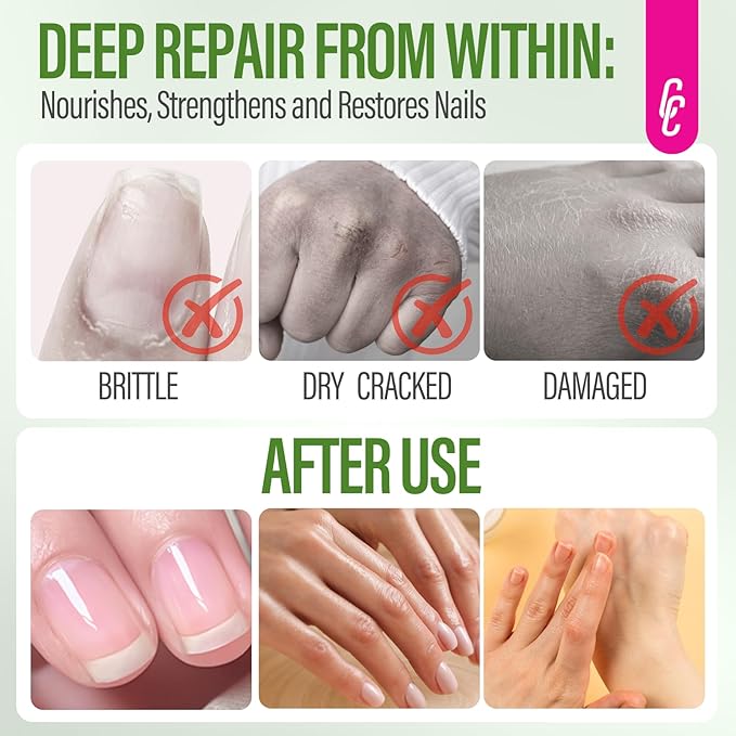 CHUCHU Nail Growth Serum for Summer: 15ML Aloe Vera Organic Nail Oil with Vitamin B & E - Moisturizes Repairs and Promotes Nail Growth - Prevents Dryness Hangnails Non-Greasy
