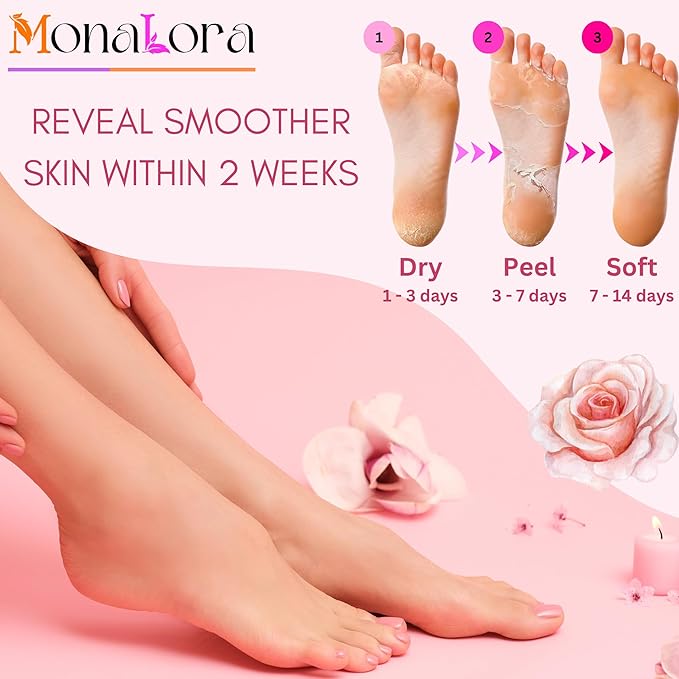 Foot Peel Mask for Dry, Cracked Heels – Exfoliating Callus Remover with Natural Fruit Extracts – Baby Soft Feet in 1 Week – 2 Packs | Strawberry Scent