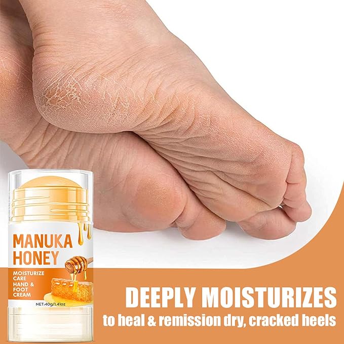 NovaCharm 2PCS Urea Cream 60 Percent for Feet, Maximum Strength Urea Foot Cream Stick, Foot Moisturizer Lotion for Cracked Heels, Dry Hands & Rough Knees (1.4Ounce(Pack of 2), Honey)