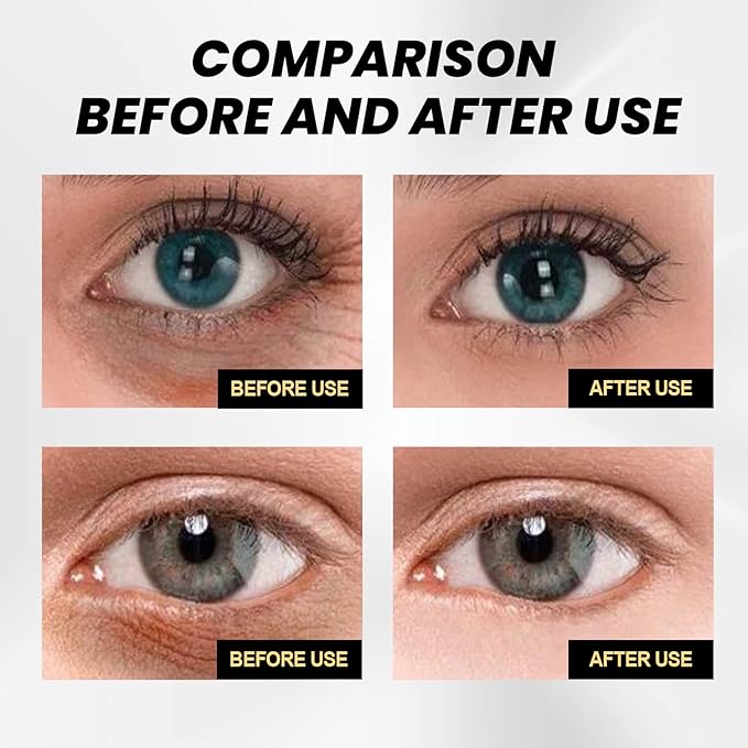 Temporary Eye Tightener Cream Advanced Instant Lift Formula with L-Carnosine for Dark Circles and Puffiness 2Piece