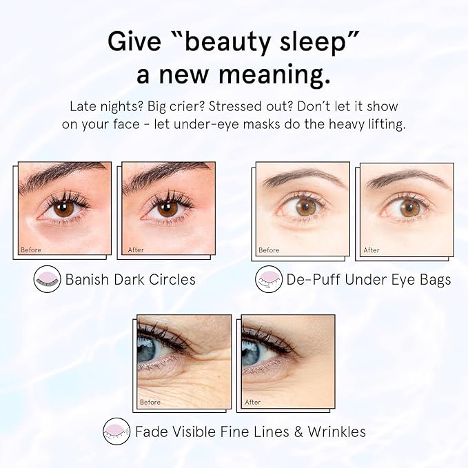 grace & stella Retinol Under Eye Patches for Puffy Eyes & Dark Circles - Restoring Gel Under Eye Masks with Hyaluronic Acid - Birthday Gifts for Women, Bachelorette Party Favors (Purple, 24 Pairs)