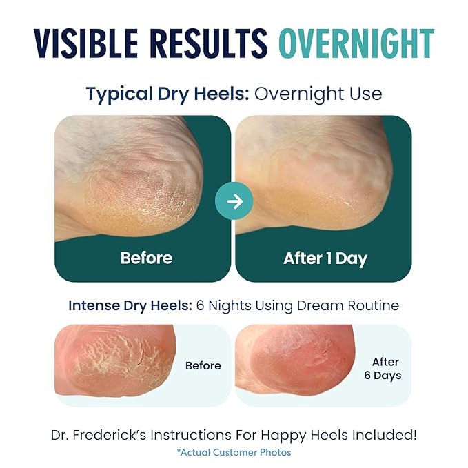 Dr. Frederick's Original Moisturizing Heel Socks for Dry Cracked Heels Treatment - Infused with Olive Oil, Jojoba Oil and Vitamin E - 2 Pairs - Self Care Gifts for Women & Men - Green Aloe