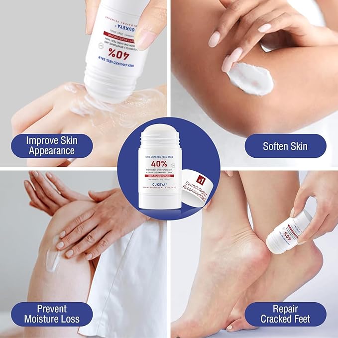 OUKEYA Urea Cream Stick 40% – for Dry, Cracked Heels & Rough Skin on Feet and Hands, 40 Percent Urea Lotion for Feet Maximum Strength,1.06 oz (2 Pack)