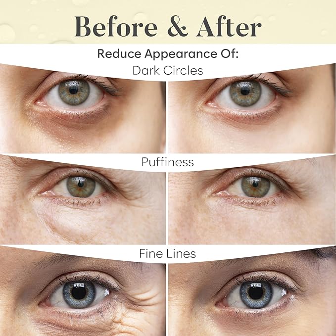 AURAE 24K Gold Under Eye Patches (30 Pairs) - For Dark Circles & Puffiness - Hydrating Eye Mask for a Revitalized Look