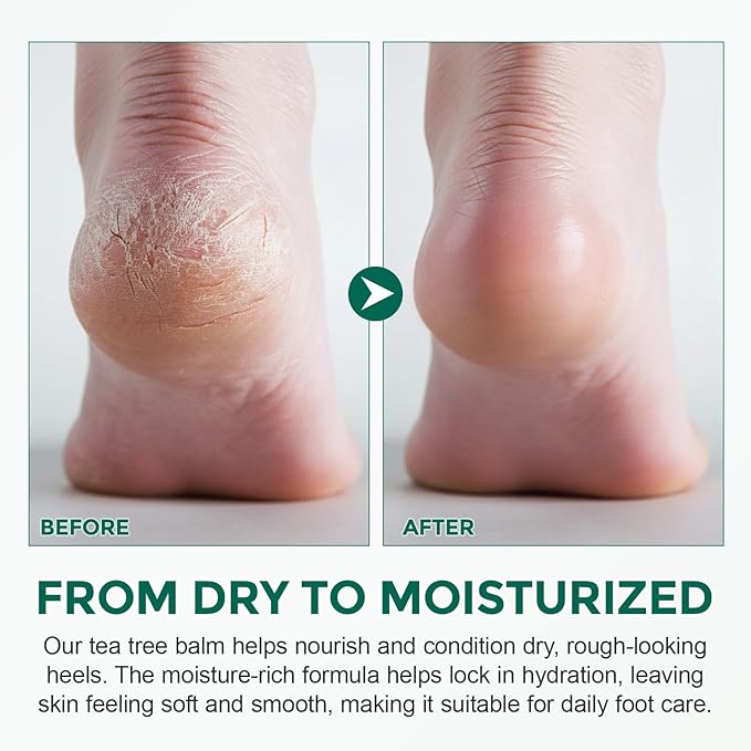 Tea Tree Oil for Skin, Tea Tree Balm 2 oz, Soothing Moisturizing Balm for Dry & Sensitive Skin, Helps Calm Itchy, Irritated Areas, Suitable for Feet, Body & Daily Use, Natural