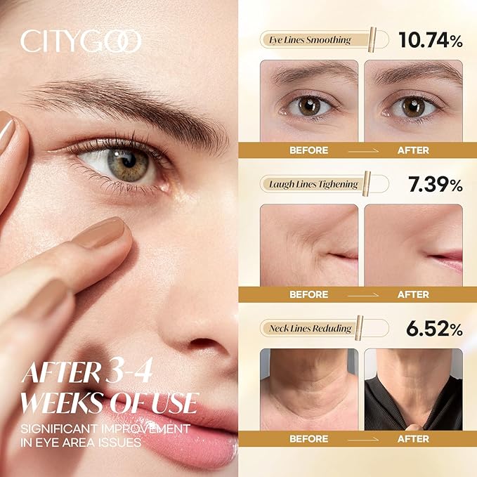 CITYGOO Retinol Eye Stick With Collagen, Hyaluronic Acid For Dark Circle, Under Eye Cream Anti Aging, For Puffiness and Bags Reduces Fine Lines (Retinol Premium Gold Edition 3g) (Matte Gold)