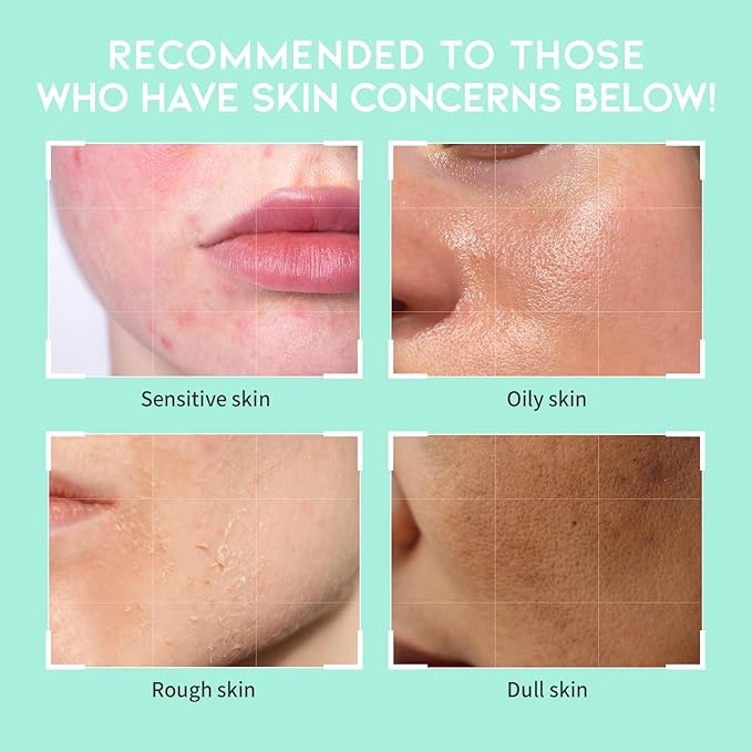 #OOTD Deep Pore Foaming Facial Cleanser For Oily Acne Prone Skin Korean, Heartleaf BHA Tea Tree Blackhead Soothing Mild Cleasning Foam. HeartLeaf Pore Zero Cleanser 200ml 6.76 Fl. Oz.