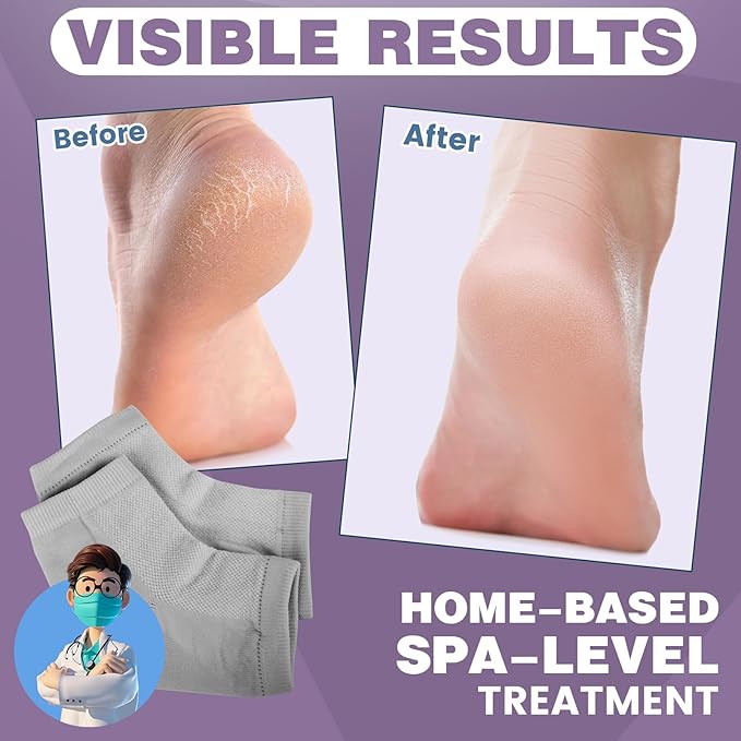 TEAWOO 5 Pairs Moisturizing Socks (2 Silicone Socks & 3 Heel Socks) for Dry Cracked Feet, Spa Gel Socks Foot Care After Pedicure, Toeless Socks to Soften and Hydrate Feet Heels