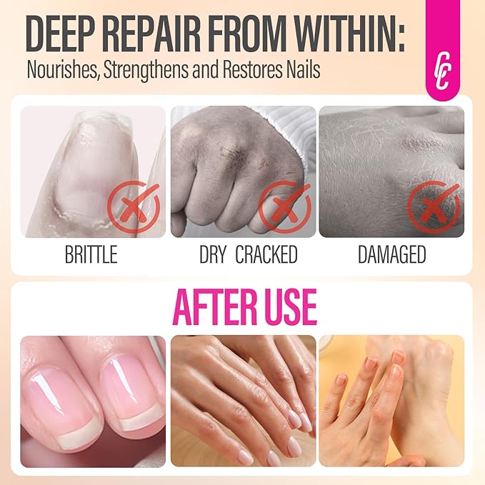 CHUCHU Nail Growth Serum for Summer: 15ML Milk Honey Organic Nail Oil with Vitamin B & E - Moisturizes Repairs and Promotes Nail Growth - Prevents Dryness Hangnails Non-Greasy