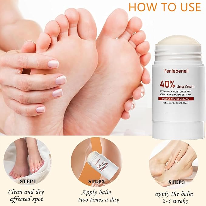 40% Urea Cream Cracked Heel Balm with 40% for Dry, Cracked, Heals Feet Hand Moisturizing Lotion 40 Percent Urea Lotion for Feet Maximum Strength 3Pack