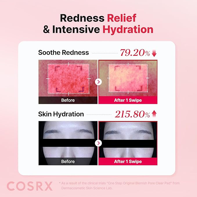 COSRX OneStep Original Blemish Pore Clear Pad, 100 Pads, Dual-Sided Facial Pad for Exfoliation, Pore Care & Hydration with BHA, PHA & Zinc PCA & 5 Hyaluronic Acid, Korean Skin Care