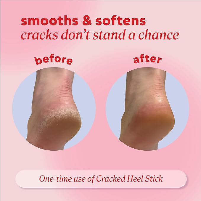 Onyx Professional Cracked Heel Repair Balm Stick for Dry Cracked Feet Treatment, Coconut Scent, 2 pack - Moisturizing Foot Balm, Rolls On, Cracked Heel Treatment