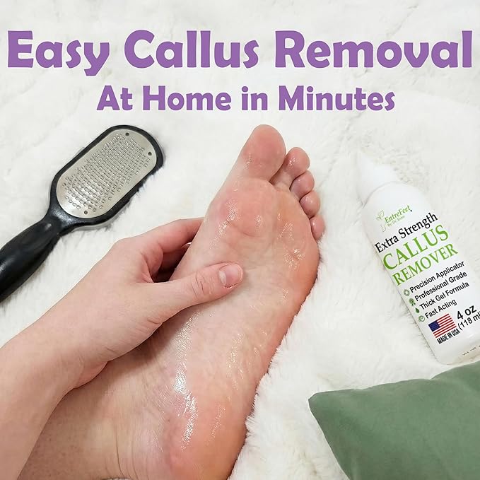 Dr. Entre's Callus Remover Gel & Foot File: Extra Strength Callus Remover for Feet, Foot Callus Remover Care, Pedicure Tools Supplies, Spa Kit, Dead Skin Scrubber, 4 oz