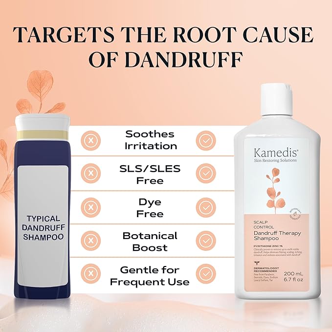 KAMEDIS Scalp Savior – Itchy Dry Scalp Treatment & Seborrheic Dermatitis Relief. Anti Dandruff Shampoo Clinically Formulated With Zinc Pyrithione & Salicylic Acid. Gentle SLS Free Formula. 16.9 Fl Oz