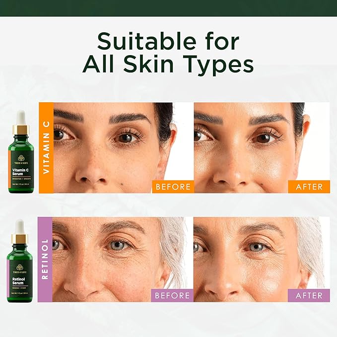 Facial Skin Care Set, Brightening, Firming, Hydrating, Dry Face, Dermatologist Tested - Vitamin C Serum (Brightens) + Retinol Serum (Smooths) - Skin Care Kit, 2 count of 1 Fl Oz