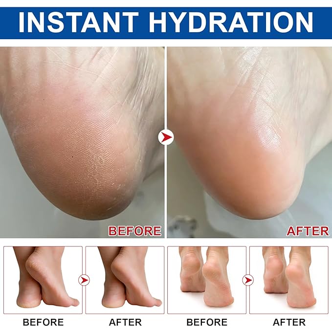 Urea Cream Stick, Maximum Strength Urea Foot Cream for Dry Cracked Feet, Knees, Hands, Exfoliating Dead Skin,Foot Care Cream Moisturizer 2 Pack