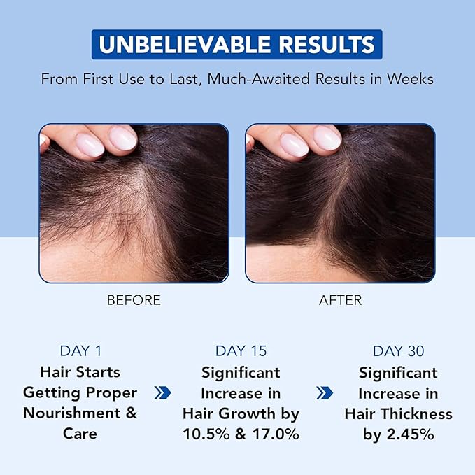 Botanic Hearth Hair Oil for Hair Growth | Rosemary Oil for Hair Growth with Biotin, Castor & Jojoba | Hair Relaxers & Dry Scalp Treatment | Color Safe | All Hair Types | 6.7 Fl Oz