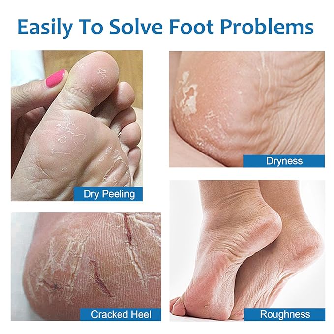 60% Urea Cracked Foot Heel Sticks - 2PCS Foot Balm Cream for Dry Cracked Feet with ALoe Vera Moisturizing Stick - Soften Feet Calluses Rough Skin Elbows Knees Hands - Foot Moisturizer Lotion for Women