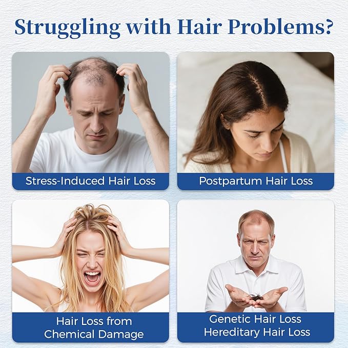 Hair Growth Serum Roll On with Rosemary，Helps Support Thicker, Fuller Hair Appearance，Clean, Non-Greasy Hair Loss Support for Men & Women，Saw Palmetto，0.84 Fl Oz (Pack of 2)