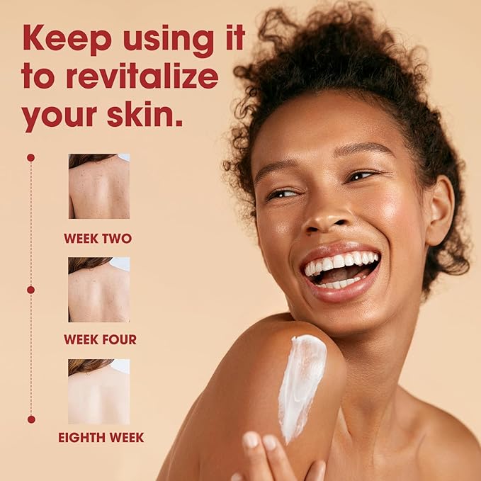 Skin Treatment Resurfacing Cream for Keratosis Pilaris, Advanced Triple-Acid AHA BHA PHA Exfoliator Lotion — Smooths Chicken Skin Bumps, Hydrating, Brightening & Soothing