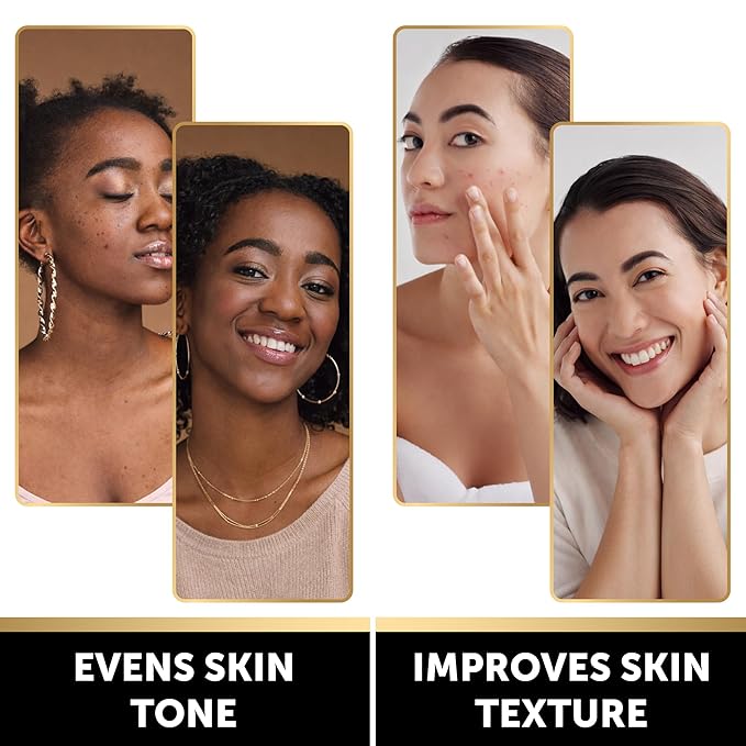 VALITIC Brightening Lemon & Turmeric Kojic Acid Soap with Vitamin C, Retinol, Collagen - Original Japanese Complex Infused with Hyaluronic Acid, Vitamin E, Shea Butter, Castile Olive Oil (4 Pack)