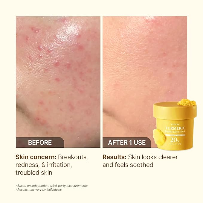 P.CALM Turmeric Bubble Deep Mask | Dark Spot Corrector with AHA/BHA, Carbonated Water Soothes Redness & Evens Skin Tone, Clay Wash-Off Pack | Korean Skincare, 90g / 3.17 oz
