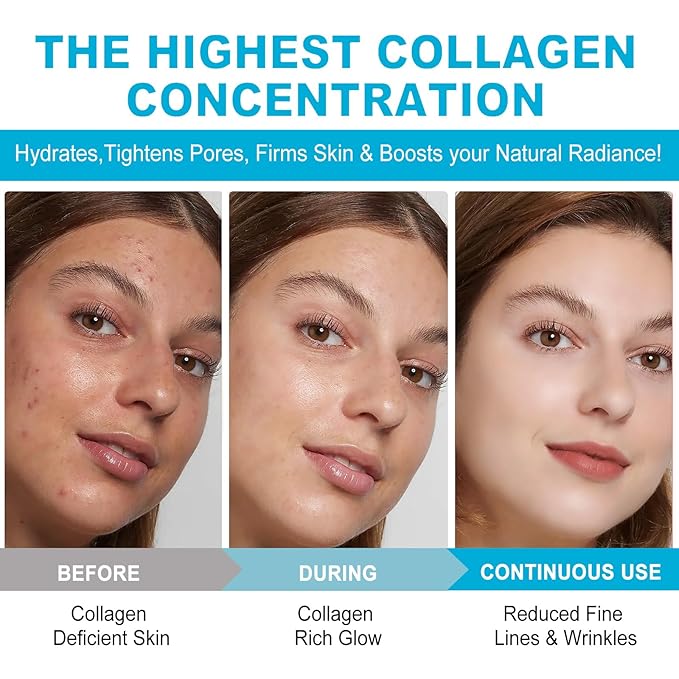 Xsvseie Collagen Face Mask, Deep Collagen Anti Wrinkle Lifting Mask Hydrogel Masks with Low Molecular Sheet Mask Overnight Hydrating Face Mask for Firming,Elasticity, Moisturizing for All Skin Types