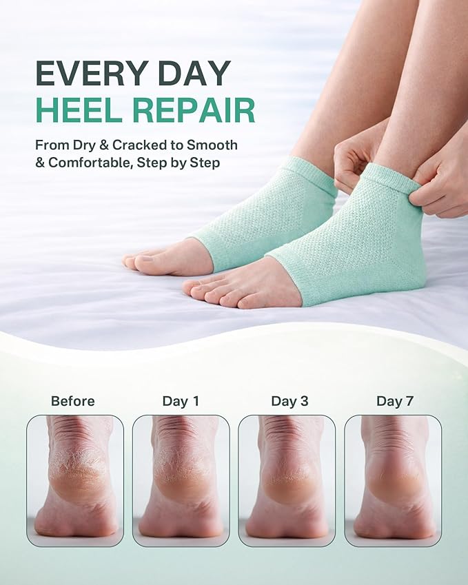 Moisturizing Socks, 100% Cotton Heel Socks for Dry Cracked Feet Women, Cracked Heel Treatment Silicone Heel Socks, Breathable Hydrating Gel Heel Protectors for Repair, Spa & Daily Use, 2 Pairs Green