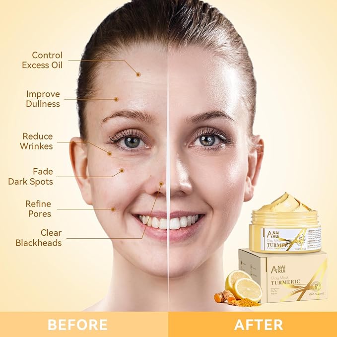 Turmeric Vitamin C Face Mask, Deep Cleansing Clay Mask for Dull Skin, Skincare Facial Mask for Refining Pores and Controlling Oil, Smooth & Radiant Skin, Face Skincare Gifts, 4.23 OZ