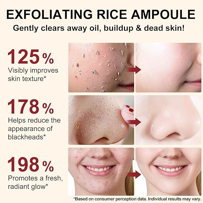 White Rice Exfoliant, White Rice Peeling Glow Ampoule, Peel Shot Glow Exfoliating Face Serum, Korean Skin Care Soft Exfoliating Body Scrub Dead Skin Cells, Blackheads Remover For All Skin Types 100ml