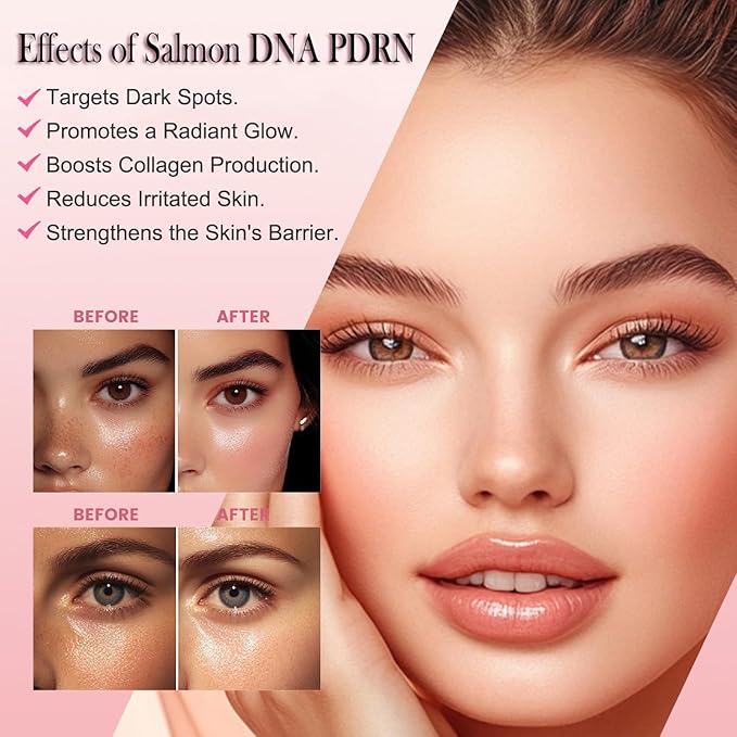Mtmult Salmon DNA PDRN Serum - PDRN Salmon DNA Anti-Aging Ampoule with 99% Salmon DNA PDRN, Collagen & Hyaluronic Acid, 0.05 fl.oz x 30e, Firming & Moisturizing - Fuses Salmon DNA Power