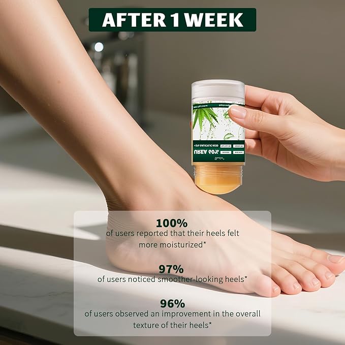 Urea 60% Cream with 2% Salicylic Acid – Maximum Strength Foot, Hand and Elbow Cream for Dry, Cracked Skin, Toenail Softening with Aloe Vera,Tea Tree & Jojoba Oil 2.65 oz.