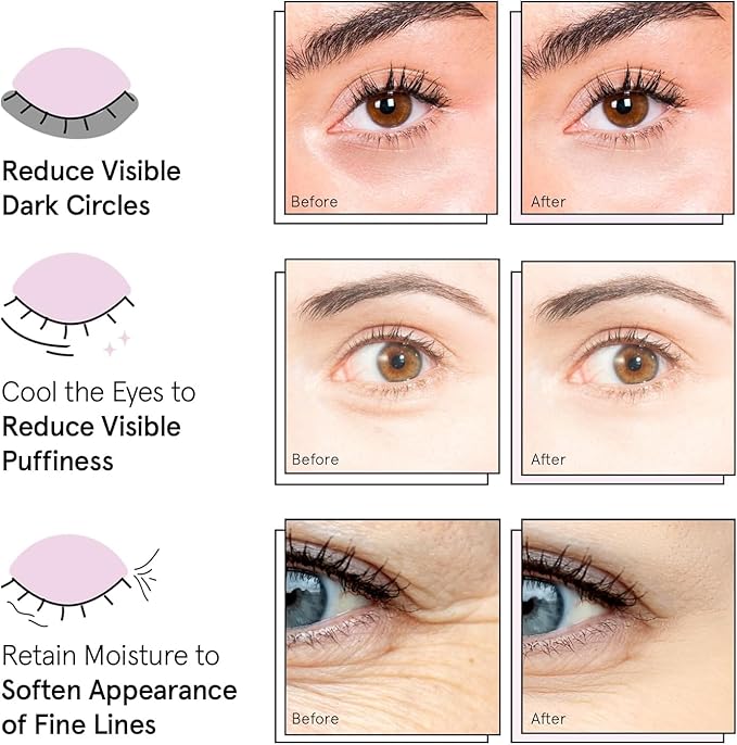 grace & stella Award Winning Under Eye Mask - Birthday Gifts for Women - Gel Eye Patches for Dark Circles, Puffy Eyes, Undereye Bags - Gifts for Mom - Vegan Self Care (24 Pairs, Gold)