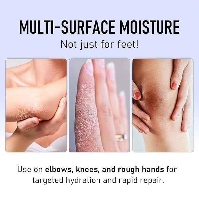 2Pcs Crack Feet Prevention Stick, Moisturizing and Hydrating Foot and Hand Balm, Remove Dead Skin Softening and Nourishing Anti-Cracking Foot Cream for Feet Elbows Knees