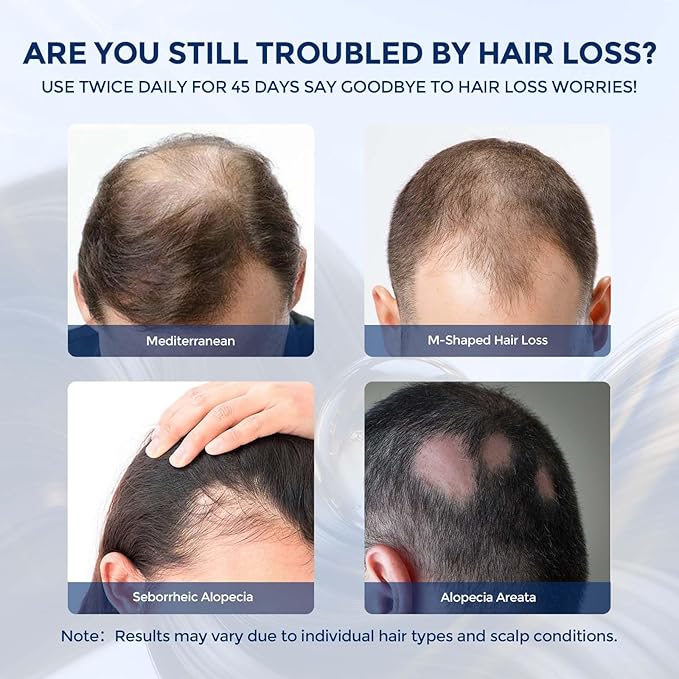 Hair Growth Spray,Hair Growth Serum for Women & Men,Hair Regrowth Treatment with Biotin & Rosemary Oil,Hair Loss Treatment Spray for Thinning Hair,Non-Greasy Scalp Care,2.029 Fl Oz
