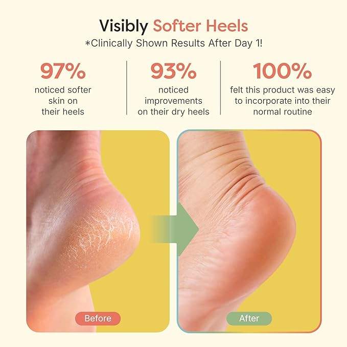 ZenToes Moisturizing Socks for Cracked Heel Treatment, Vitamin E, Olive Oil and Jojoba Oil Infused Heel Socks, Spa Gifts for Women, Mothers Day Gifts (Fuzzy Lilac Purple, Regular)