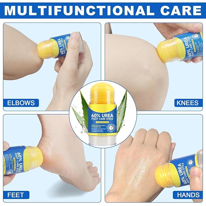 60% Urea Cream Stick with 2% Salicylic Acid, Maximum Strength Foot Care Balm, Callus Remover & Exfoliating Moisturizer for Dry Cracked Feet, Heels, Hands, Knees Elbow & Skin