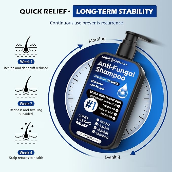 Antifungal Psoriasis Shampoo for Seborrheic Dermatitis, Folliculitis & Scalp Psoriasis, Anti-Dandruff Shampoo for Men & Women, Relieves Scalp Itching, Dryness, Sulfate & Paraben-Free, 10.1 Fl Oz-Fresh