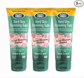 Dermatonics 10% Urea Callus Removing Cream – Removes Hard Skin, Moisturizes and Rehydrates Racked, Rough, Dead and Dry Skin – for Feet, Elbows, and Hands, 2.37 fl oz. Tube, 3 Pack